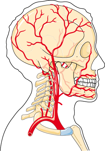 Anatomy illustration of Cervicogenic Headache