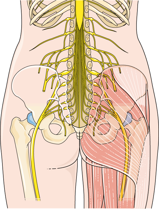 Anatomy illustration of Sciatica