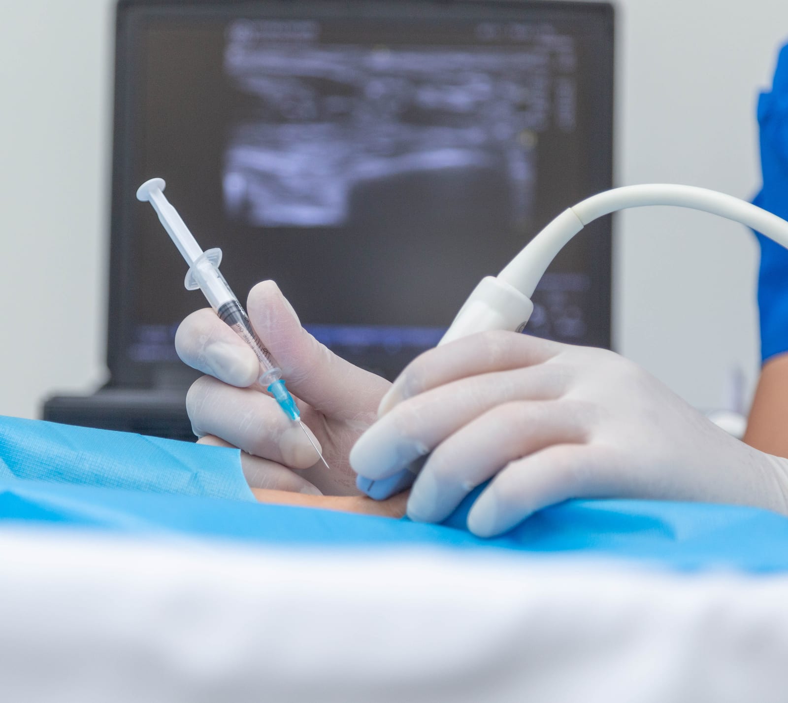 Hyaluronic Acid Injection at GABA Pain Center