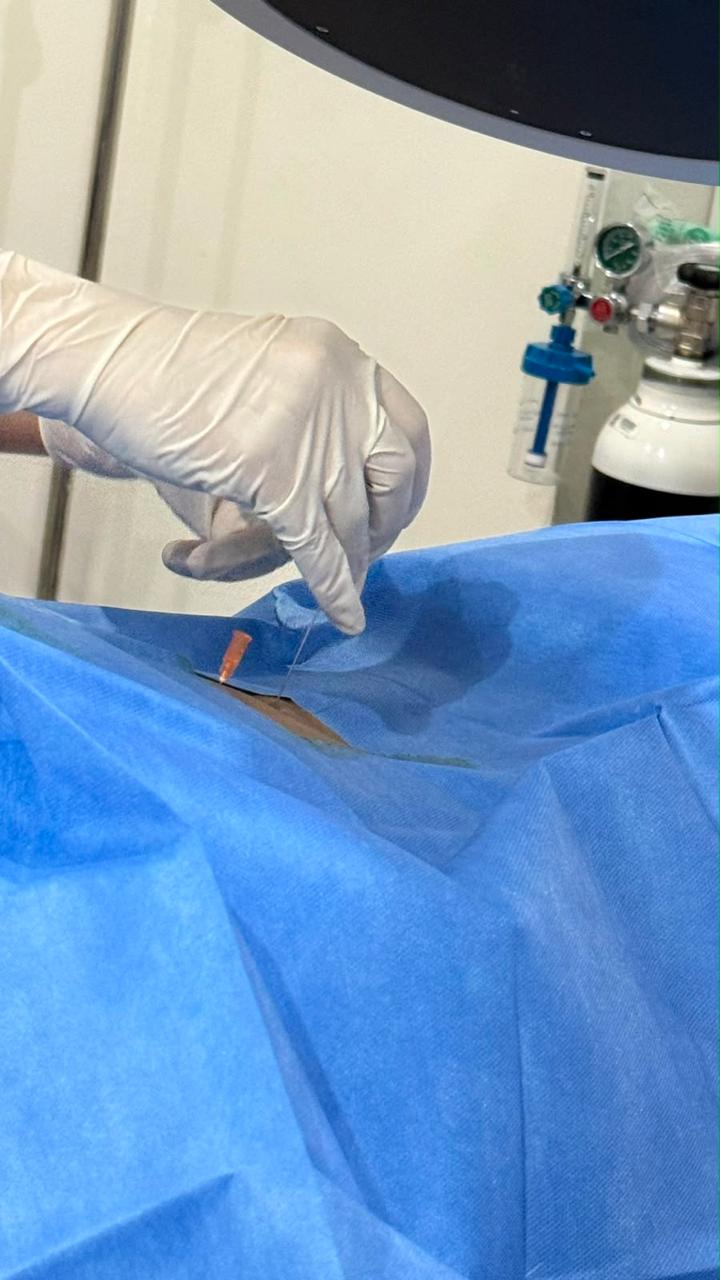 Nerve Blocks at GABA Pain Center